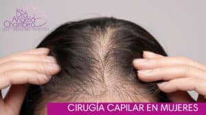 cirugía capilar en mujeres
