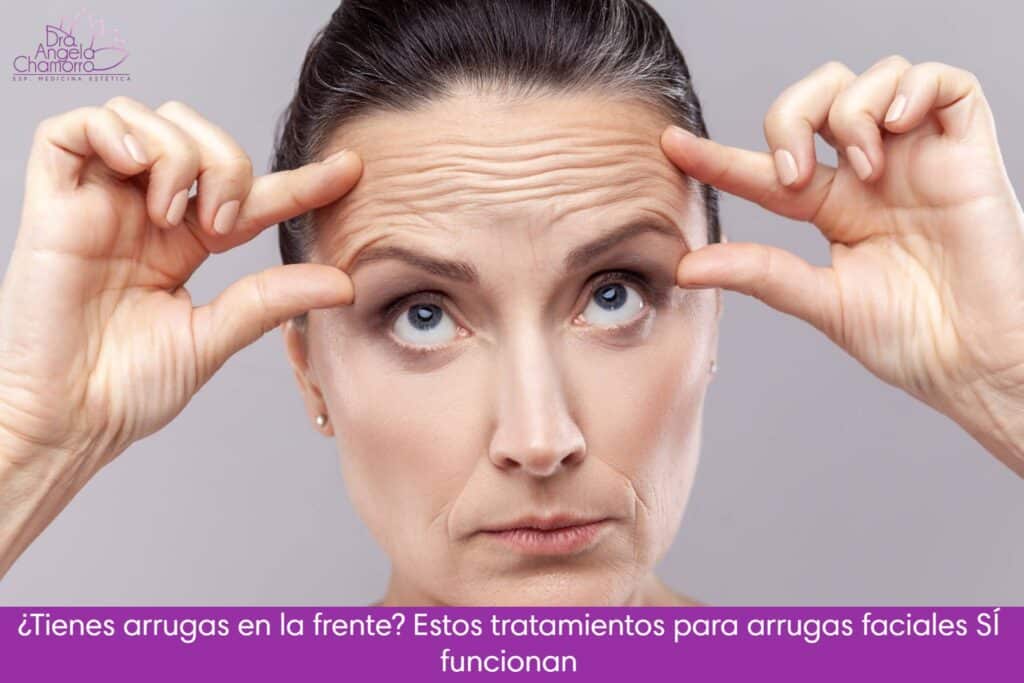 ¿Tienes arrugas en la frente? Estos tratamientos para arrugas faciales sí funcionan