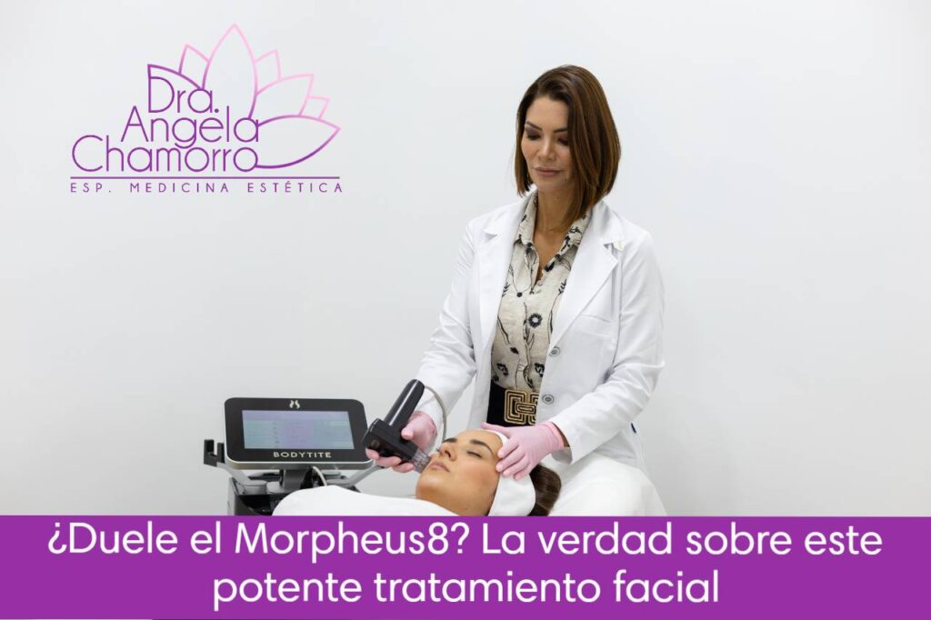 ¿Duele el Morpheus8? La verdad sobre este potente tratamiento facial