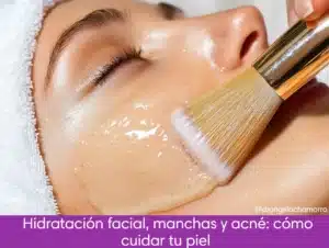 imagen para texto sobre hidratación facial, manchas y acné