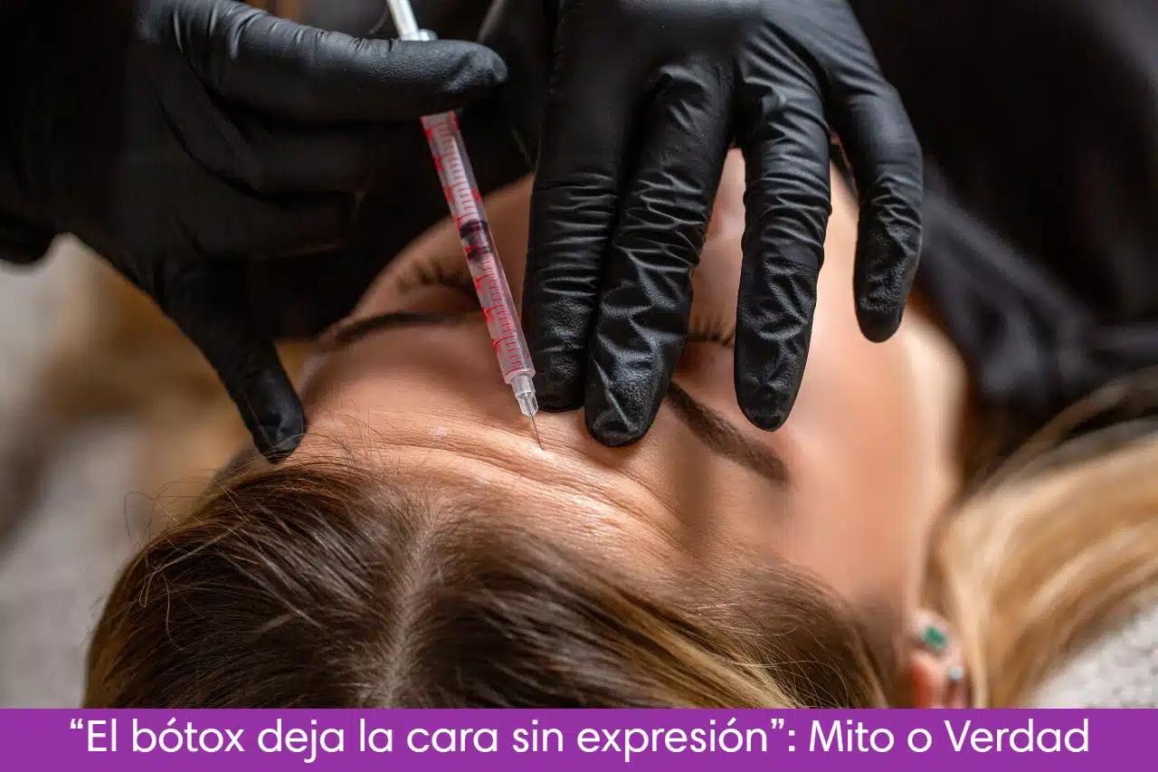 La toxina botulínica aplicada correctamente, deja un expresión natural