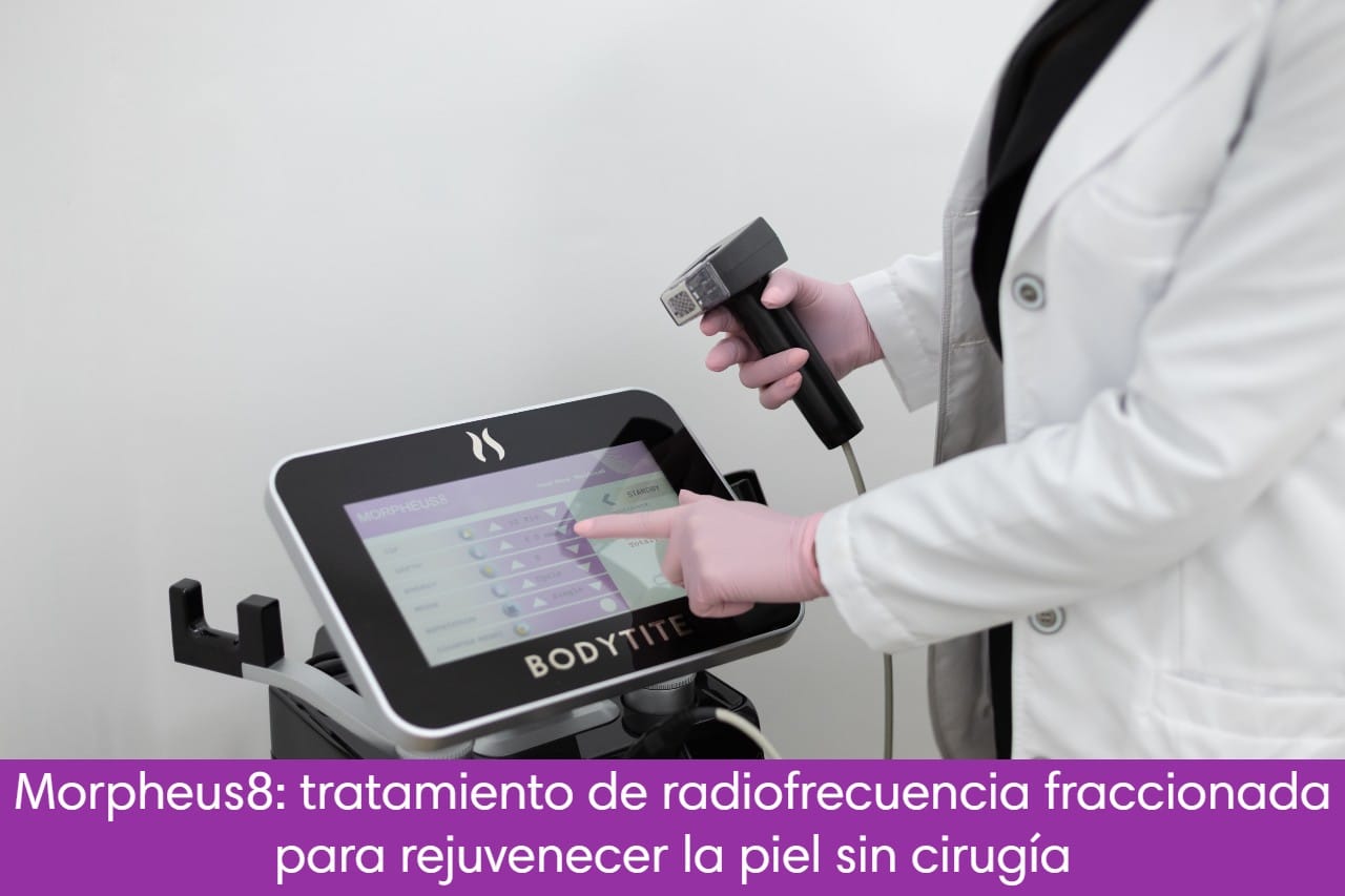 Morpheus8: tratamiento de radiofrecuencia fraccionada para rejuvenecer la piel sin cirugía